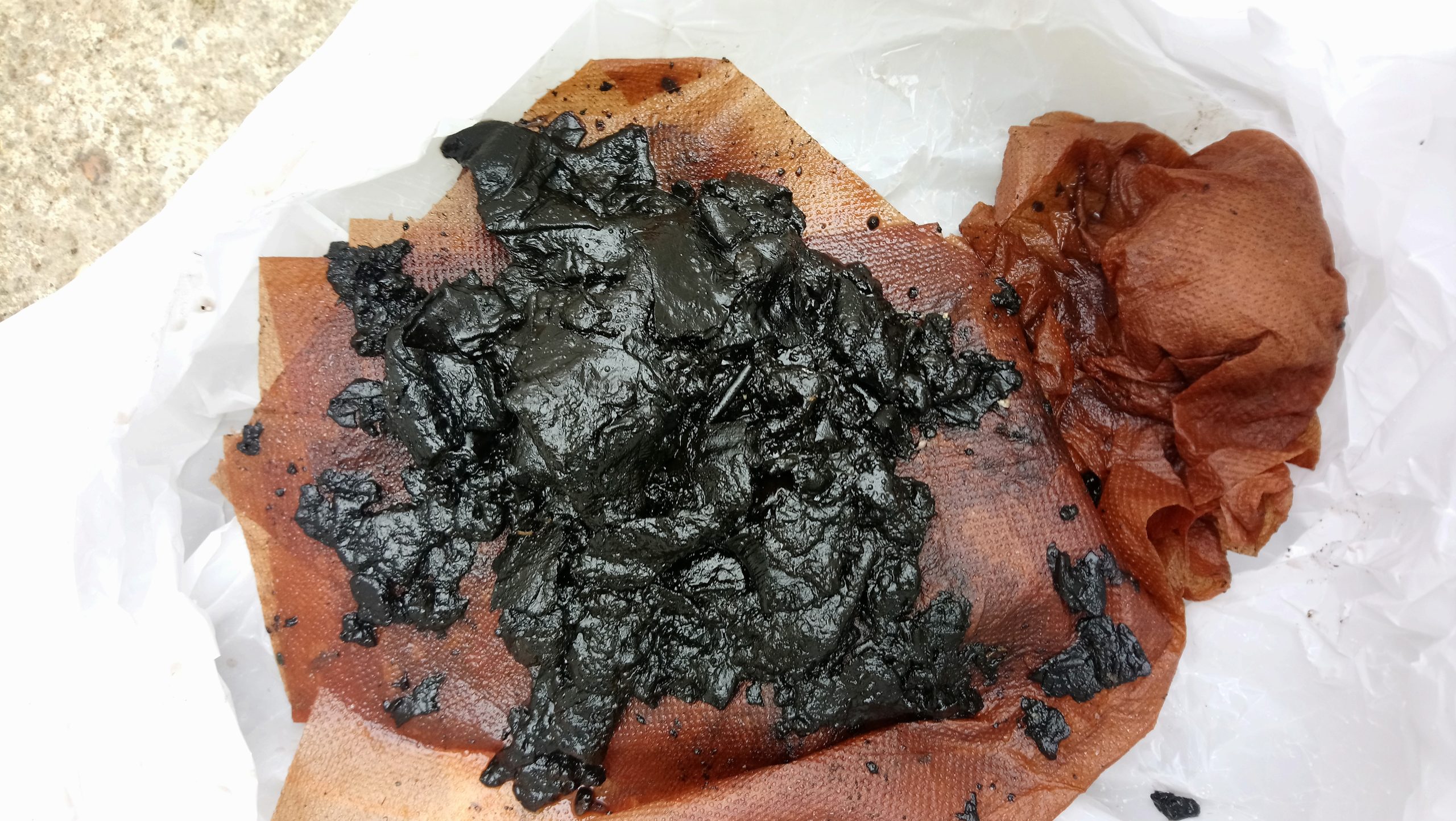 Des déchets que vous n&rsquo;imaginez pas